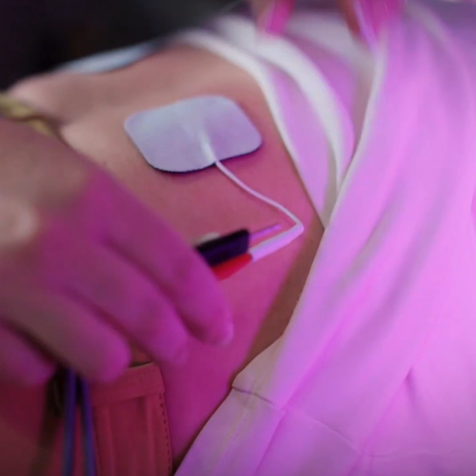 Terapia TENS (Electroestimulación)