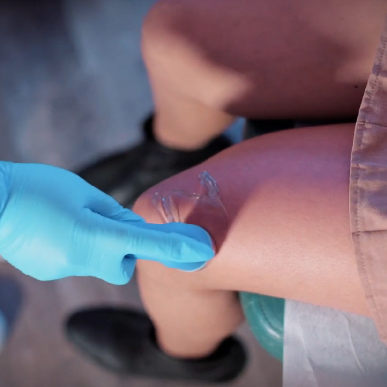 Terapia de Ultrasonido